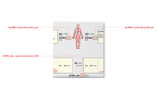 Rozšíření přístroje o modul měření rychlosti pulzové vlny