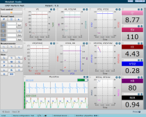 METASOFT STUDIO - rozhraní pro zařízení PhysioFlow Enduro