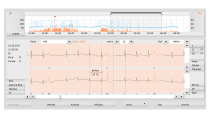 Holter EKG Custo - SW přehled ... Holter EKG Custo flash 510, vč. SW