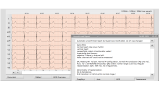 Modul Interpretace a srdeční variability pro EKG Custo