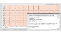 Modul Interpretace a srdeční variability pro EKG Custo