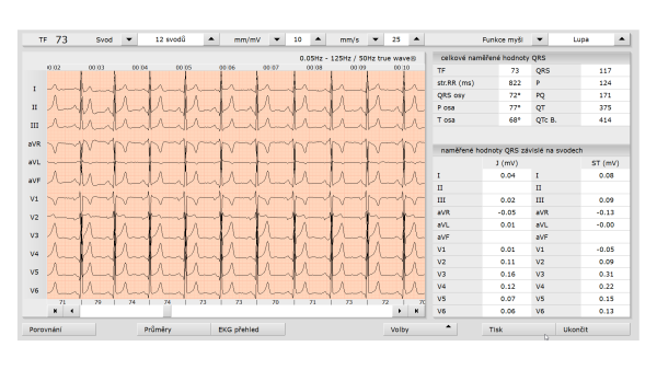 Software custo diagnostic standard
