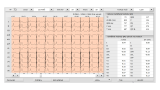 KLIDOVÉ PC-EKG, CUSTO CARDIO 300 Bluetooth / USB