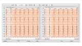 KLIDOVÉ PC-EKG, CUSTO CARDIO 300 Bluetooth / USB