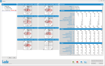 Software Lode Ergometry Manager - LEM 10