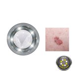 Dermatoskop LuxaScope CCT LED 2.5V, bílý, se stupnicí