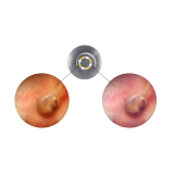 Otoskop LuxaScope Auris CCT LED, modrý