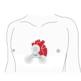 PADSY-Holter se záznamníkem ECG Time S