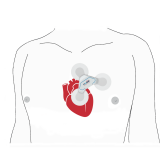 PADSY-Holter se záznamníkem ECG Time S