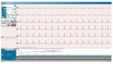 Zátěžové + klidové BLUETOOTH PC-EKG PADSY (ECG Top BT)