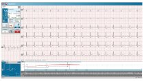 PADSY Ergo - obslužný a vyhodnocovací SW pro zátěžové EKG (ergometrii) EKG ZÁTĚŽOVÉ - MEDSET FLASHLIGHT ERGO, EKG jednotka Flashlight USB