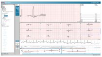 PADSY Ergo - obslužný a vyhodnocovací SW pro zátěžové EKG (ergometrii) Zátěžové USB PC-EKG PADSY (ECG Top D)