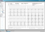 Klidové PC-EKG PADSY-EKG