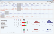 Oscilografický pletysmograf Sonotechnik AngE Pro 4 /8 - analýza pletysmografické křivky Pletysmograf 8kanálový AngE Pro 8